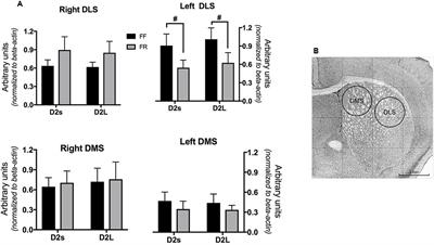 Stress-Induced Reduction of Dorsal Striatal D2 Dopamine Receptors Prevents Retention of a Newly Acquired Adaptive Coping Strategy